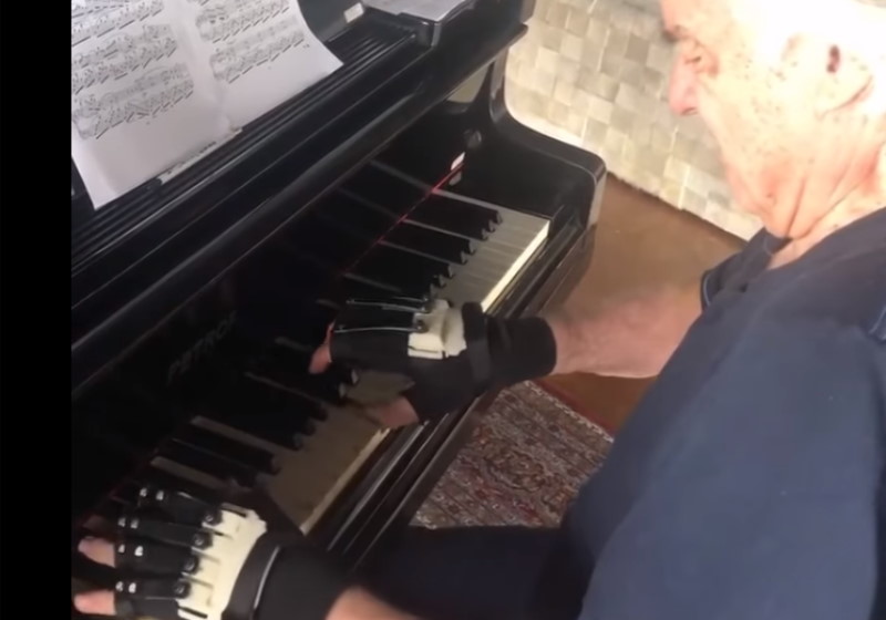 Ο πιανίστας Ζοάο Κάρλος Μαρτέν ξαναπαίζει με τη βοήθεια βιονικών γαντιών