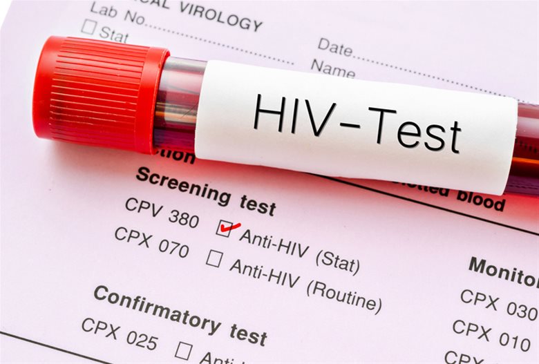 HIV εξετάσεις