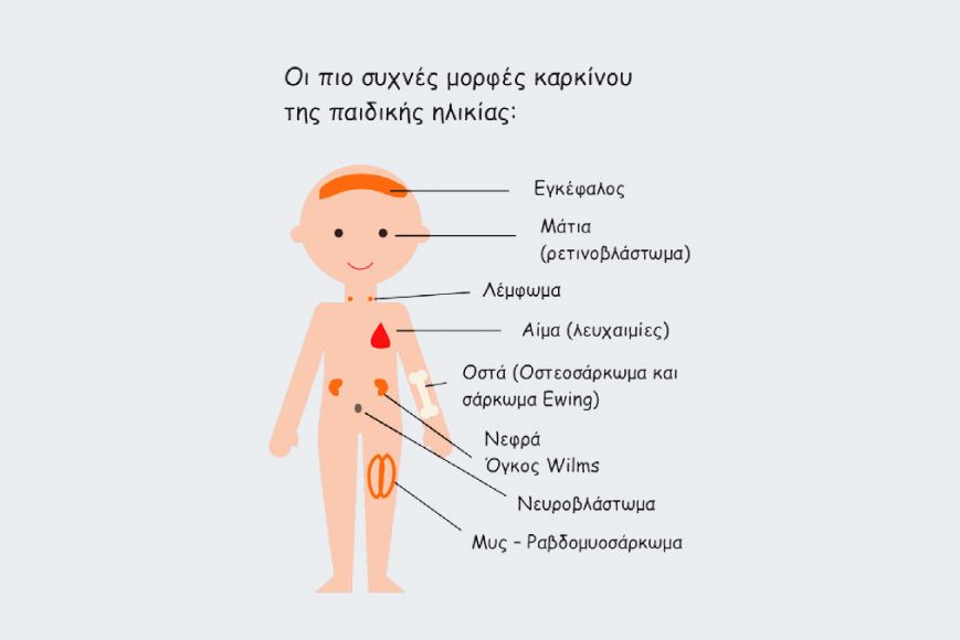 Παιδικού Καρκίνου